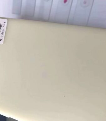 Set 50 preparate microscopice patologii histologice umane 1